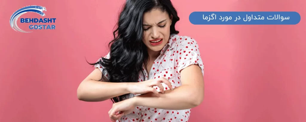 سوالات متداول در مورد اگزما